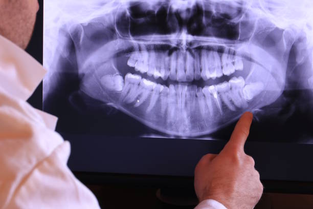 Best Urgent Care for Lost Fillings or Crowns in Kachina Village, AZ