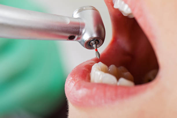 Best Emergency Treatment for Dental Infections or Abscesses in Kachina Village, AZ
